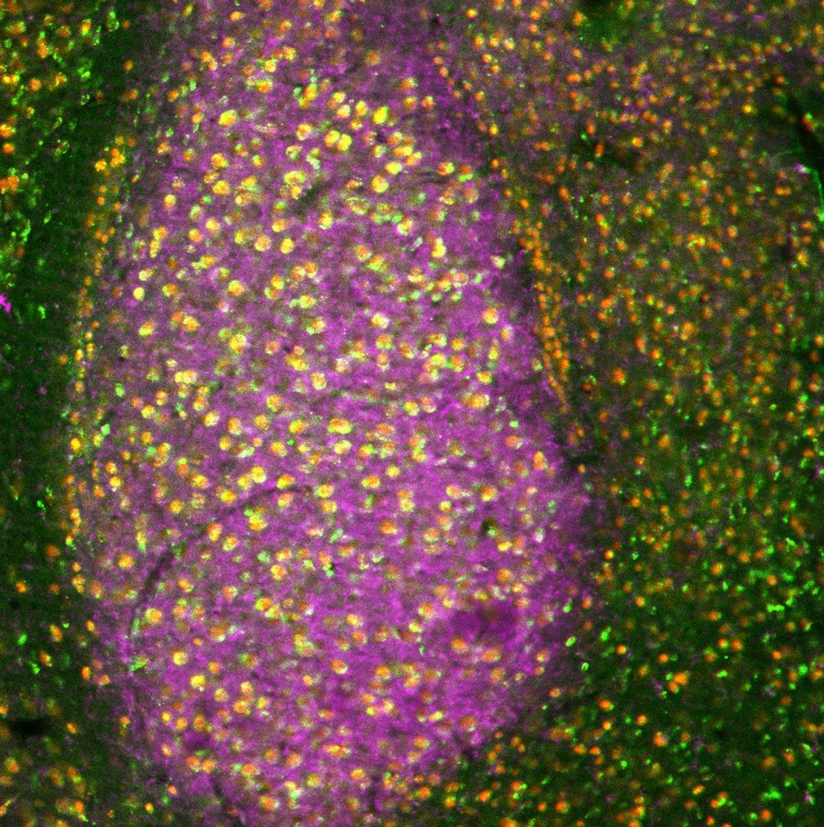 The image shows a brain section of the mouse amygdala. Using fluorescent markers, the expression of synapses is shown in purple, while neurons are shown as red dots and the microRNA miR-483-5p is shown as green dots.