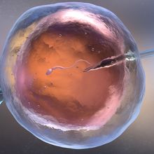 Image of in vitro fertilization