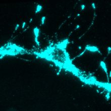 Blue glowing neuron projections