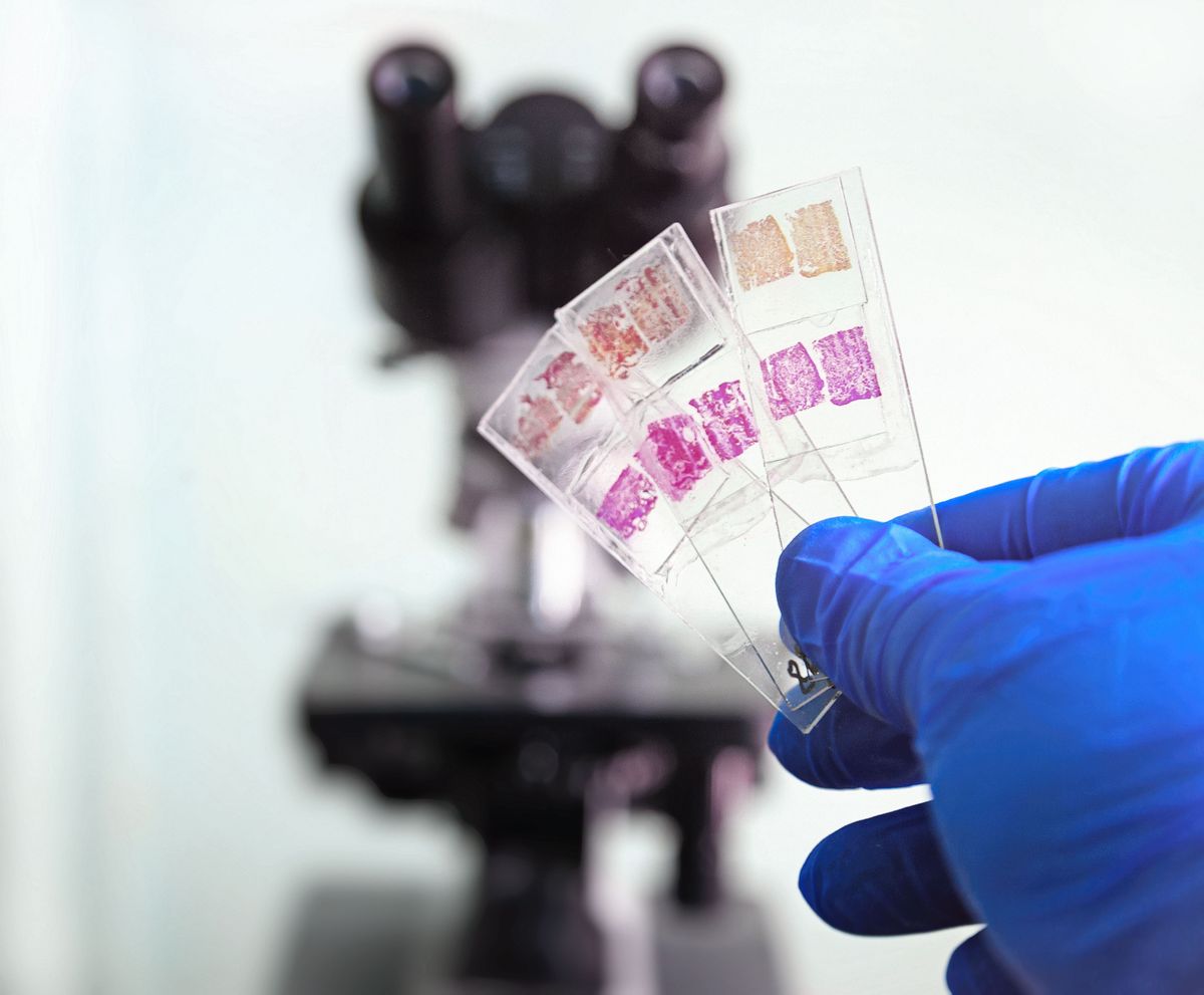 A gloved hand holding three glass slides with stained tissue samples in front of a microscope.