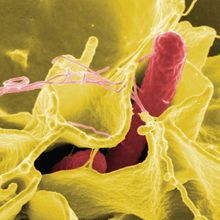 Salmonella (pink) invading a human epithelial cell (yellow)