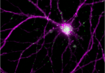 Brain cell in purple on a black background. Arc mRNAs are labeled green and are mainly localized in the cell nucleus and in the dendrites.