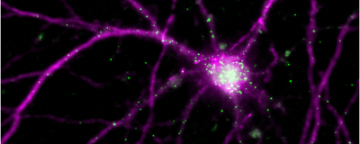 Brain cell in purple on a black background. Arc mRNAs are labeled green and are mainly localized in the cell nucleus and in the dendrites.