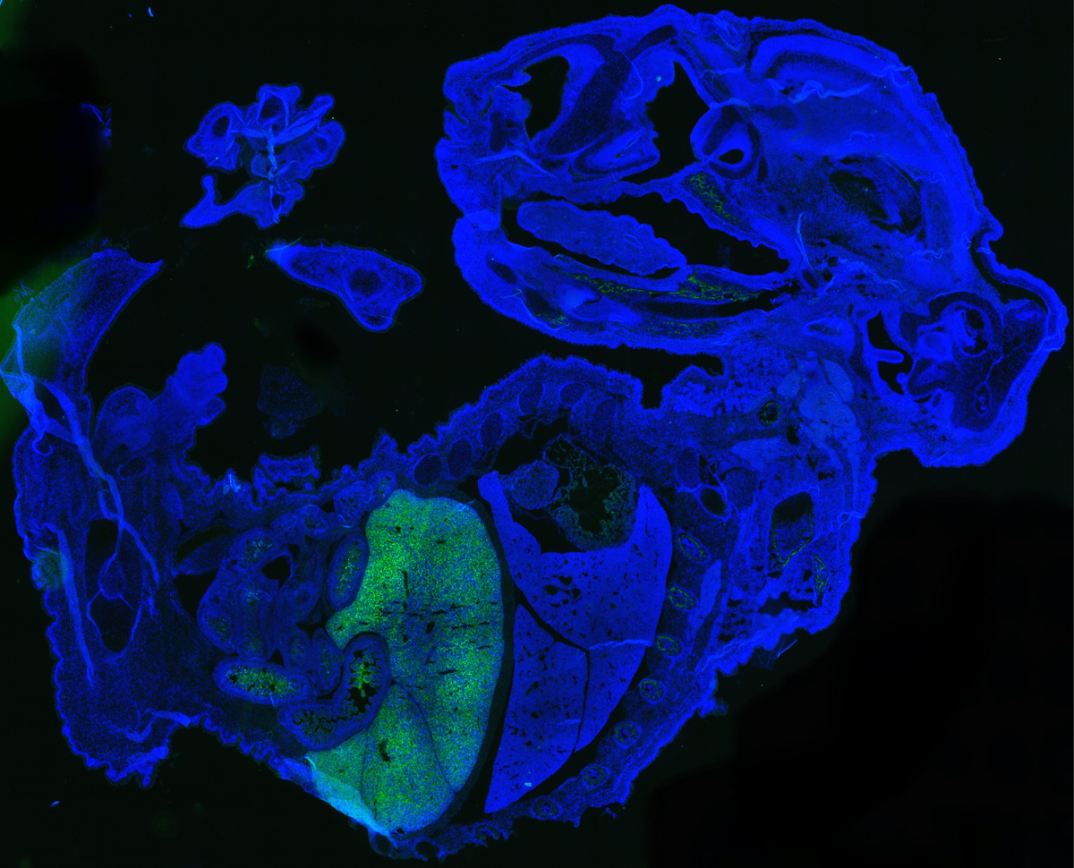 A blue mouse embryo section, with human cells that are labeled green.