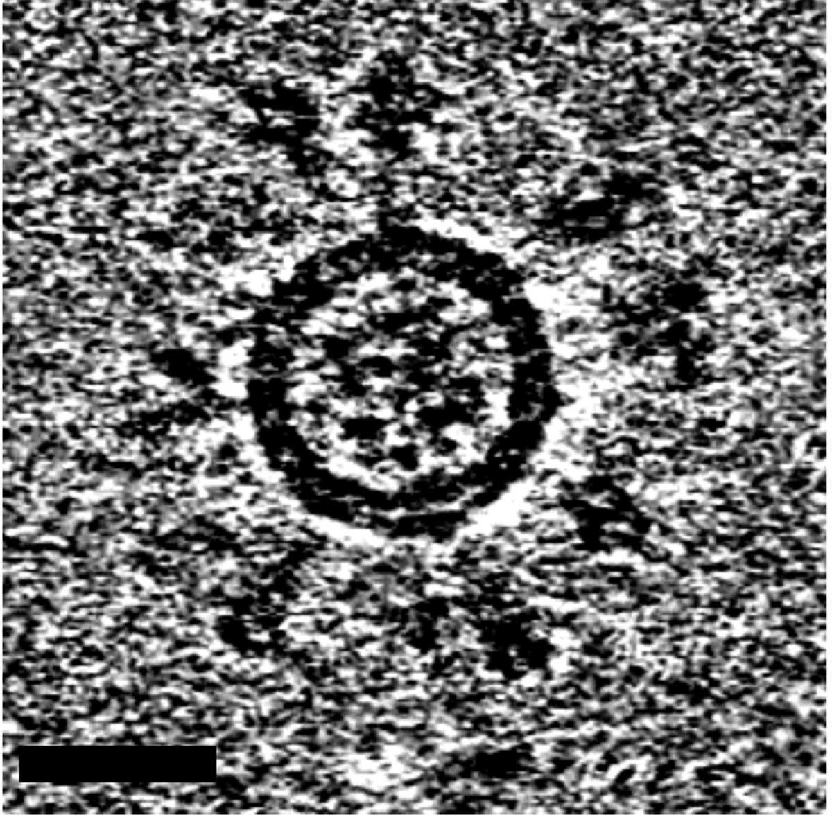 SARS-CoV-2 self-assembling virus-like nanoparticle with spike proteins protruding from the surface.